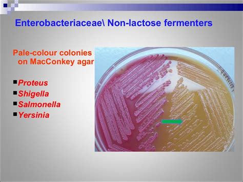 does shigella ferment lactose.